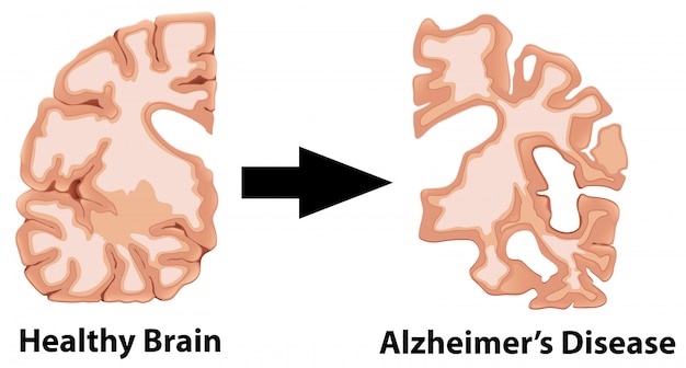 Une anatomie humaine du cerveau Vecteur gratuit