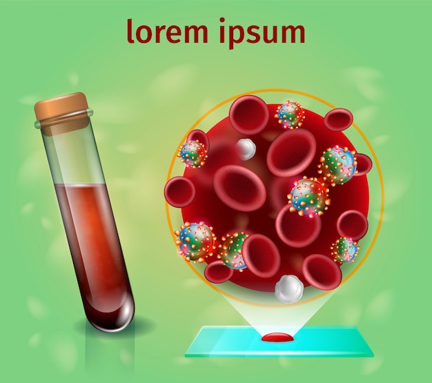 Diagnostic du cancer avec test sanguin de laboratoire Vecteur Premium
