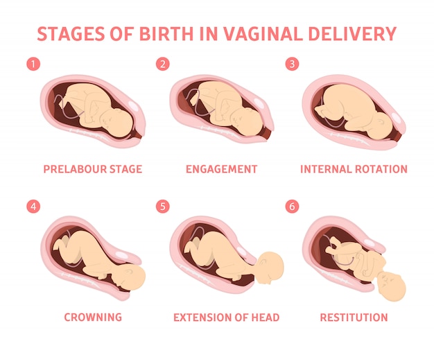 tapes-de-l-accouchement-par-voie-vaginale-vecteur-premium