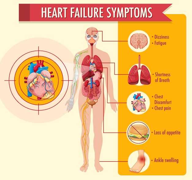 Infographie D informations Sur Les Symptômes D insuffisance Cardiaque Vecteur Gratuite