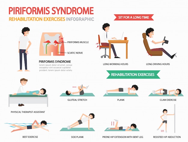 Rééducation du syndrome de piriformis exercices infographiques