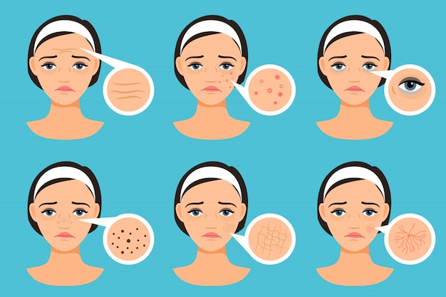 Visage féminin avec illustration vectorielle de problèmes de peau. femme avec des problèmes Vecteur Premium
