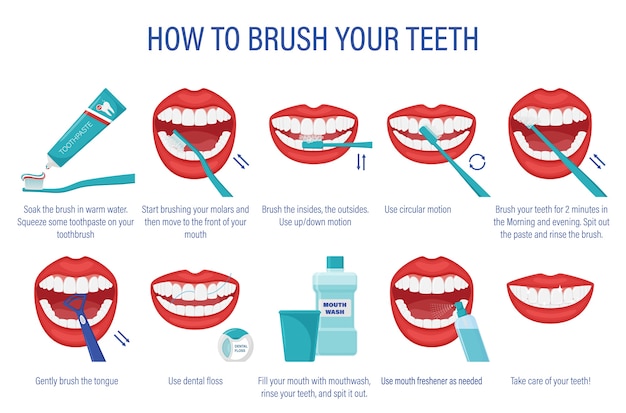 Esquema De Cómo Cepillarse Los Dientes. Instrucciones Paso A Paso ...