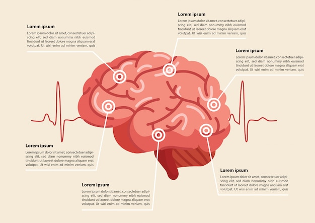 Ilustración De Accidente Cerebrovascular Humano Vector Premium