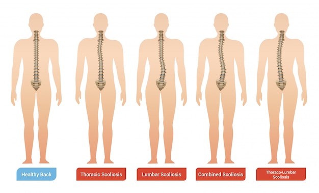 Imagenes De Dolor Columna Vectores Fotos De Stock Y Psd Gratuitos