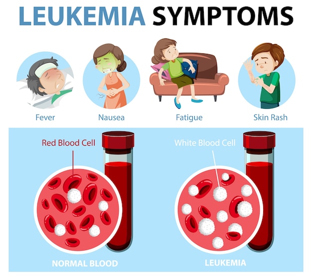 Infografia De Estilo De Dibujos Animados De Sintomas De Leucemia Vector Gratis