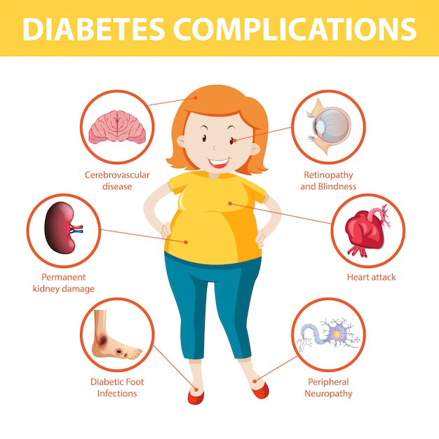 Infografía De Información Sobre Complicaciones De La Diabetes Vector