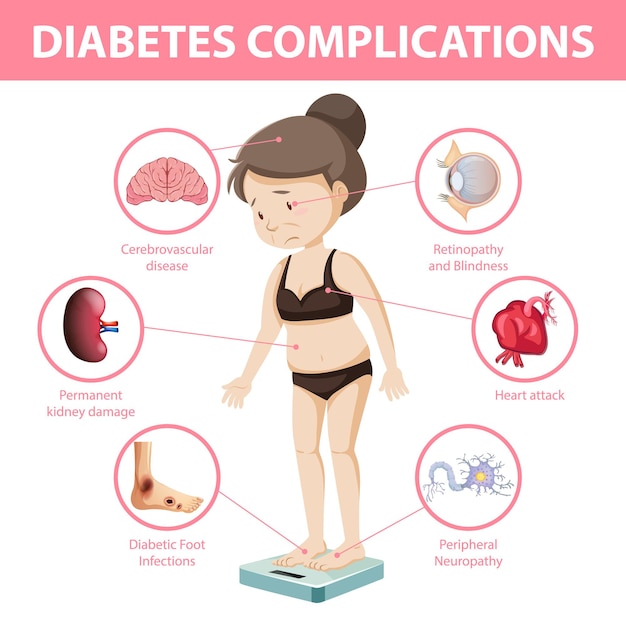 Infografía De Información Sobre Complicaciones De La Diabetes Vector