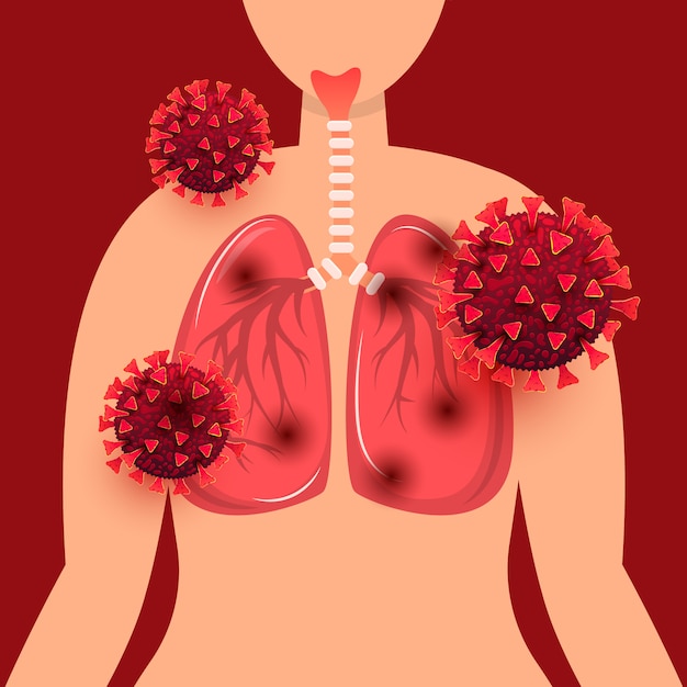 Pulmones Humanos Infectados Con El Concepto De Infecci N Por Coronavirus Covid Brotes Y