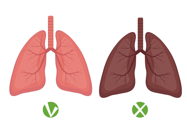 Pulmones sanos y enfermedad de los pulmones o infografía de fumador aislado sobre fondo blanco