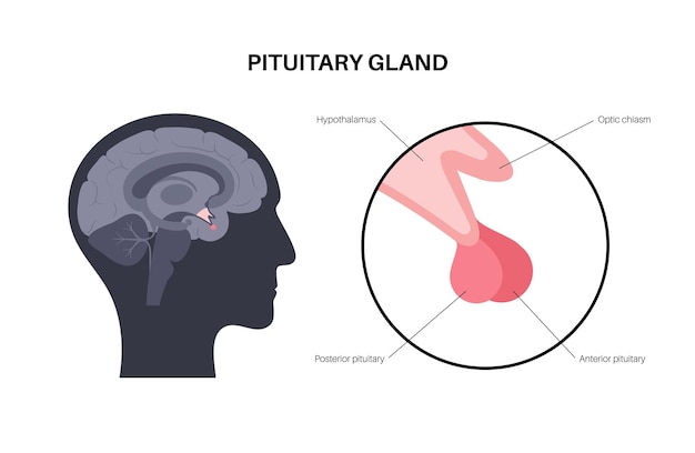 Anatomia Da Glândula Pituitária Conceito De Sistema Endócrino Humano Cérebro E Hipotálamo 8283