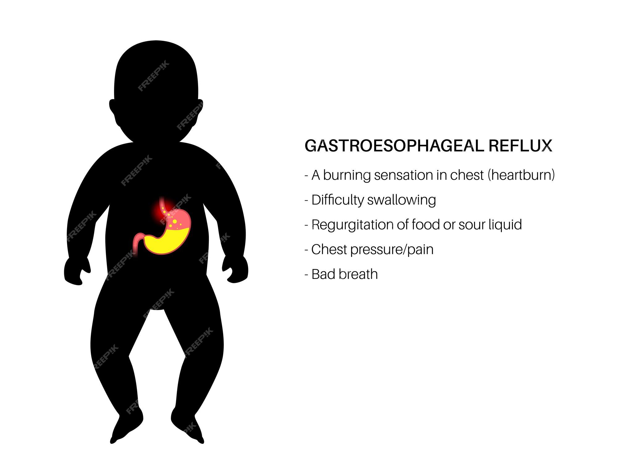 Doen a do refluxo gastroesof gico na silhueta infantil dist rbio