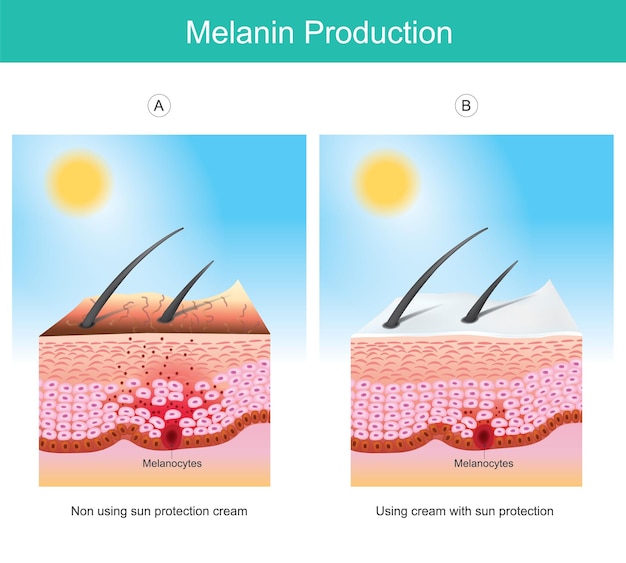 produ-o-de-melanina-a-ilustra-o-que-mostra-a-cor-da-pele-humana