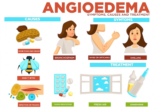 Angioedema O Que E Causas Sintomas E Tratamento NBKomputer