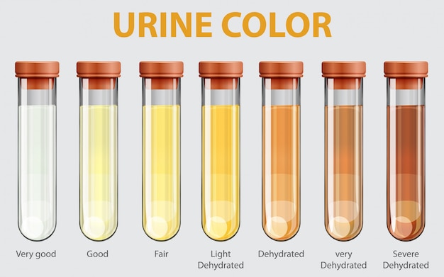Illustrazione della cartella colori delle urine Vettore
