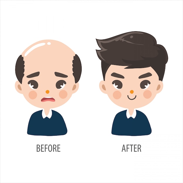 Kale man zonder vertrouwen en lang haar mannen zien er knap uit. Premium Vector